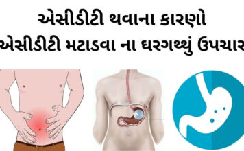 એસીડીટી ના કારણો - એસીડીટી નો ઘરગથ્થું ઉપચાર - એસીડીટી નો ઉપચાર - એસીડીટી થવાના કારણો - acidity na gharelu upchar - acidity dur karvana upay