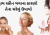 dry skin solutions home remedies Gujarati - ડ્રાય સ્કીન થવાના કારણો અને તેના ઘરેલું ઉપાયો