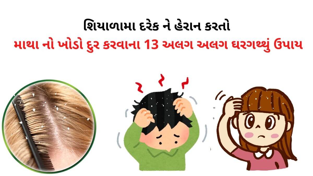 how to remove dandruff in Gujarati - ખોડો દૂર કરવાના ઉપાયો - ખોડો થવાના કારણો - khodo thavana karno - ખોડો સમસ્યાને દૂર કરવાના ઉપાયો