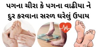 pag na chira pag na vadhiya dur krvana uppay in gujarati - પગના વાઢીયા - પગના ચીરા - પગ ફાટવા - Pag na chira dur karva na upay, Pag na vadhiya dur krvana uppay in Gujarati