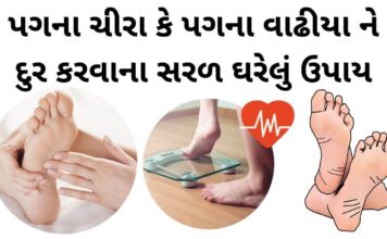 પગના ચીરા | પગના વાઢીયા ને દુર કરવાના સરળ ઘરેલું ઉપાય pag na chira pag na vadhiya dur krvana uppay in gujarati - પગના વાઢીયા - પગના ચીરા - પગ ફાટવા - Pag na chira dur karva na upay, Pag na vadhiya dur krvana uppay in Gujarati