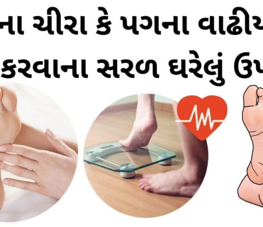 pag na chira pag na vadhiya dur krvana uppay in gujarati - પગના વાઢીયા - પગના ચીરા - પગ ફાટવા - Pag na chira dur karva na upay, Pag na vadhiya dur krvana uppay in Gujarati