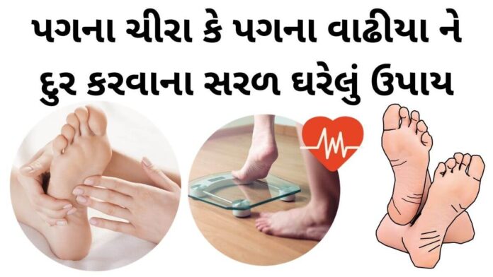 pag na chira pag na vadhiya dur krvana uppay in gujarati - પગના વાઢીયા - પગના ચીરા - પગ ફાટવા - Pag na chira dur karva na upay, Pag na vadhiya dur krvana uppay in Gujarati