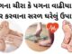 pag na chira pag na vadhiya dur krvana uppay in gujarati - પગના વાઢીયા - પગના ચીરા - પગ ફાટવા - Pag na chira dur karva na upay, Pag na vadhiya dur krvana uppay in Gujarati