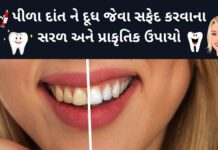 પીળા દાંત ને સફેદ કરવાના સરળ અને પ્રાકૃતિક ઉપાયો safed dant karvana gharelu upay in Gujarati - દાંત સફેદ કરવાના ઉપાય