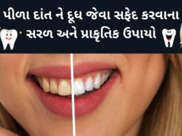safed dant karvana gharelu upay in Gujarati - દાંત સફેદ કરવાના ઉપાય