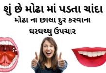 મોઢા ના છાલા દુર કરવાના ઘરઘથ્થુ ઉપચાર - મોઢા ના ચાંદા દૂર કરવાના ઘરઘથ્થુ ઉપચારો - mouth ulcer home remedies in gujarati - Modha na chanda na upay - modha ma chanda no ilaj gujarati.
