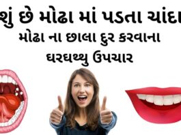 મોઢા ના છાલા દુર કરવાના ઘરઘથ્થુ ઉપચાર - મોઢા ના ચાંદા દૂર કરવાના ઘરઘથ્થુ ઉપચારો - mouth ulcer home remedies in gujarati - Modha na chanda na upay - modha ma chanda no ilaj gujarati.