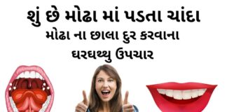 મોઢા ના છાલા દુર કરવાના ઘરઘથ્થુ ઉપચાર | Modha na chanda na upay મોઢા ના છાલા દુર કરવાના ઘરઘથ્થુ ઉપચાર - મોઢા ના ચાંદા દૂર કરવાના ઘરઘથ્થુ ઉપચારો - mouth ulcer home remedies in gujarati - Modha na chanda na upay - modha ma chanda no ilaj gujarati.