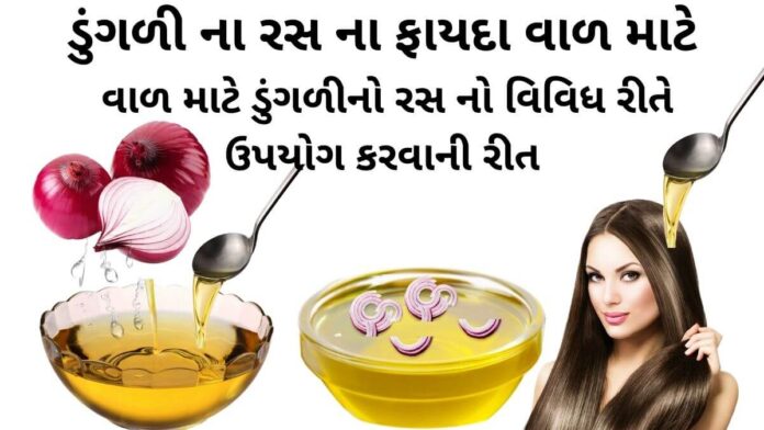 ડુંગળી ના રસ ના ફાયદા વાળ માટે - વાળ માટે ડુંગળીનો રસ - benefits of onion juice for hair in Gujarati - ડુંગળી ના રસનો ઉપયોગ