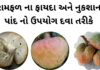 રામફળ ના ફાયદા નુકશાન અને તેના પાંદ નો ઉપયોગ દવા તરીકે | Ramfal na fayda રામફળ ના ફાયદા - રામફળ ના નુકશાન - ramfal na fayda in Gujarati