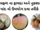 રામફળ ના ફાયદા નુકશાન અને તેના પાંદ નો ઉપયોગ દવા તરીકે | Ramfal na fayda રામફળ ના ફાયદા - રામફળ ના નુકશાન - ramfal na fayda in Gujarati