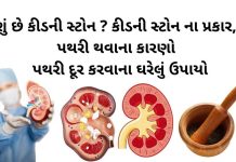 પથરી દૂર કરવાના ઉપાયો - કિડની સ્ટોન - પથરીની સારવાર - પથરી ના ઉપાય - પથરી ની દવા - કિડનીની પથરી ની દવા - pathari in gujarati - pathari mate dava -pathari ni dava gujarati ma