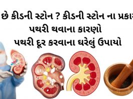 પથરી દૂર કરવાના ઉપાયો - કિડની સ્ટોન - પથરીની સારવાર - પથરી ના ઉપાય - પથરી ની દવા - કિડનીની પથરી ની દવા - pathari in gujarati - pathari mate dava -pathari ni dava gujarati ma