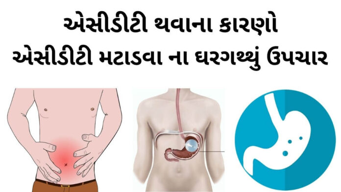 acidity na gharelu upchar એસીડીટી ના કારણો - એસીડીટી નો ઘરગથ્થું ઉપચાર - એસીડીટી નો ઉપચાર - એસીડીટી થવાના કારણો - acidity na gharelu upchar - acidity dur karvana upay