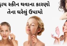 ડ્રાય સ્કીન થવાના કારણો અને તેના ઘરેલું ઉપાયો – Dry Skin Solutions Gujarati dry skin solutions home remedies Gujarati - ડ્રાય સ્કીન થવાના કારણો અને તેના ઘરેલું ઉપાયો