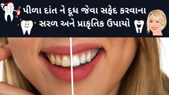 safed dant karvana gharelu upay in Gujarati safed dant karvana gharelu upay in Gujarati - દાંત સફેદ કરવાના ઉપાય