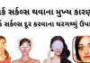 ડાર્ક સર્કલ દુર કરવાના ઉપાય | dark circles dur karna upay gujarati ડાર્ક સર્કલ દુર કરવાના ઉપાય - dark circles dur karna upay gujarati